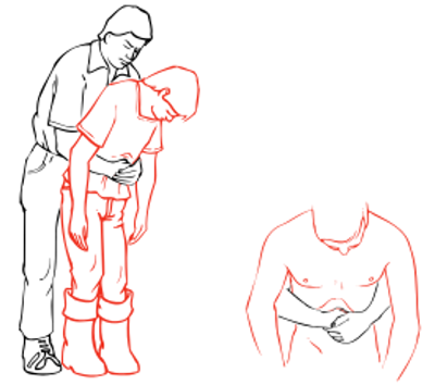 If the casualty is conscious, stand behind him, place your closed fist against the place in the upper abdomen where the ribs divide and grasp your fist with the other hand.