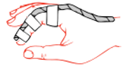 immobilise the finger in the position as shown