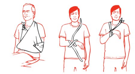 large-arm-sling