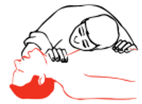 no improvement still not breathing-unconscious-position