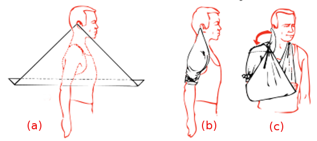 shoulder-bandage