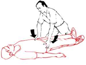 Some movement of the pelvic bones may also be felt if there is a fracture